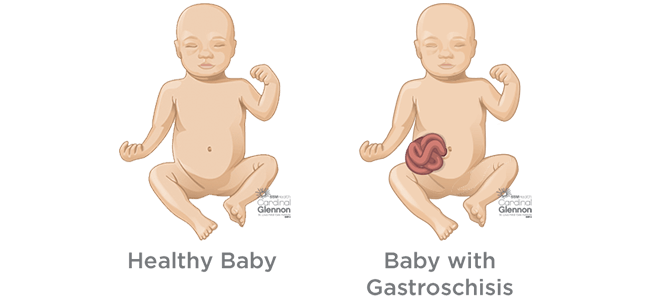 sudafed-while-pregnant-second-trimester-cardinal-glennon