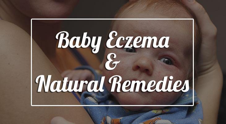 ayurvedic treatment for eczema in babies