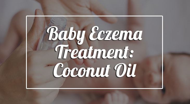 baby eczema natural remedies